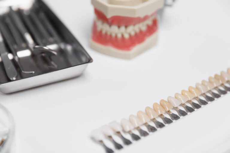 Clareamento Dental